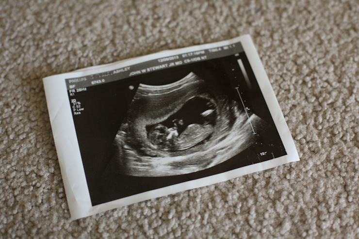 Ultrasound-Photo (1 of 1)